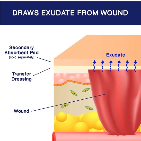 MedVance Transfer Silicone Foam dressing 8”x20” (5 sheets) NWT - Picture 7 of 7